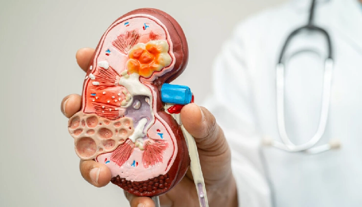 10 Fruits You Must Eat To Fight Kidney Diseases