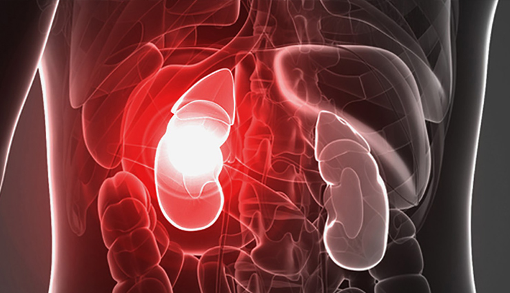 kidney failure,tv actress anaya soni kidney fail,causes of kidney fail,reason of kidney fail,kidney care tips