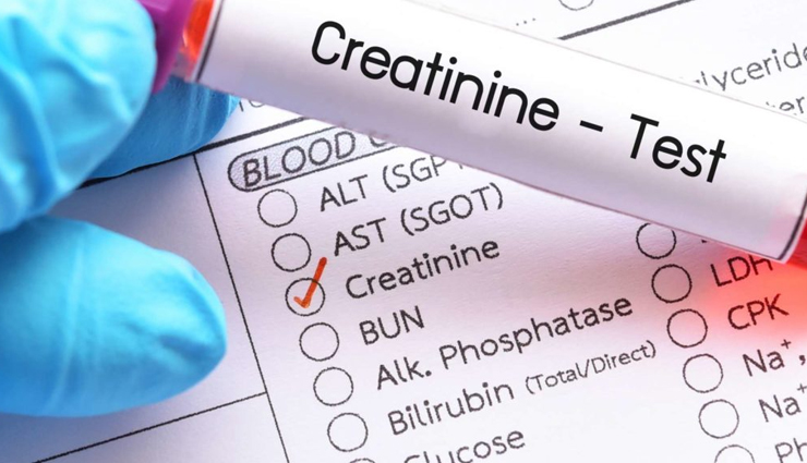 rules for kidney healthy,kidney care tips,Health tips,fitness tips