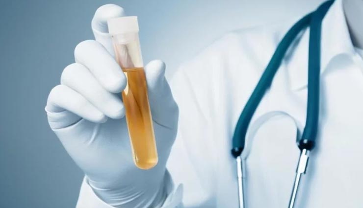 Health tips,health tips in hindi,kidney disease symptoms,care of kidney