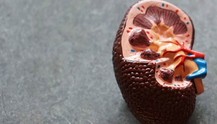 5 Ways To Treat Kidney Stone With Natural Remedies