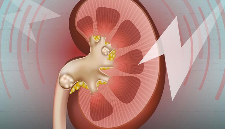 करेला बनता हैं बिमारियों का काल, रोजाना करें सेवन Health tips,health tips in hindi,bitter gourd,healthy life,healthy food