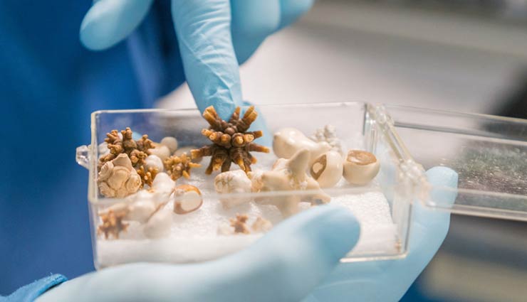 kidney stone,home remedies to treat kidney stone,Health tips,fitness tips,kidney care tips