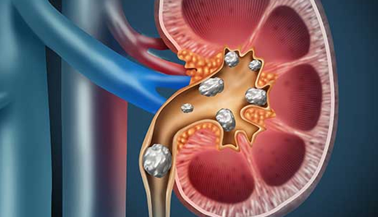 coconut water,coconut water health benefits,coconut water to reduce weight,healthy food coconut water,healthy drink coconut water,Health,Health tips