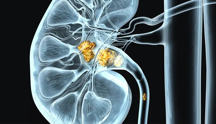 tomato side effects,negative effects of consuming tomatoes,adverse reactions to eating tomatoes,risks of tomato consumption,tomatoes and their potential side effects,tomato allergies and sensitivities,digestive issues from eating tomatoes,tomato intolerance symptoms,allergic reactions to tomatoes,tomato-related health concerns,potential drawbacks of tomato consumption