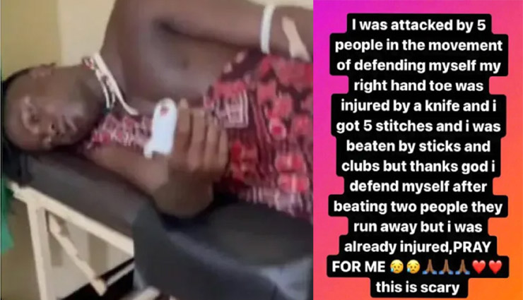 इंटरनेट सेंसेशन किली पॉल पर चाकू से हमला, डांस की PM मोदी भी कर चुके हैं तारीफ