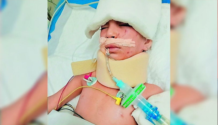 पड़ोसन को ब्वॉयफ्रेंड के साथ देखना बच्ची को पड़ा भारी, अब कभी सुन-बोल नहीं पाएगी