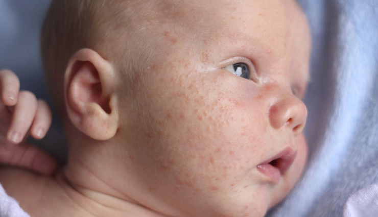 risks of kissing a baby,dangers of kissing babies,health risks of kissing newborns,parental awareness: risks of kissing a baby,potential dangers of kissing infants,baby health hazards: kissing precautions,kissing babies: health risks parents should know,importance of being aware of kissing risks for parents,baby safety: risks associated with kissing,protecting your baby: understanding the risks of kissing