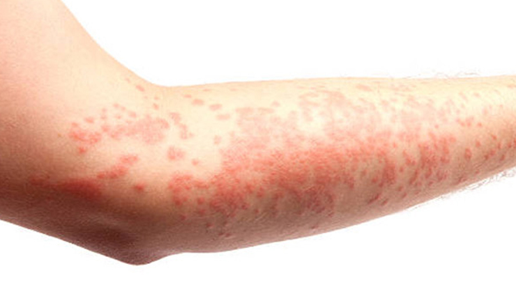 kiwanos,health benefits of  kiwanos,Health tips,fitness tips