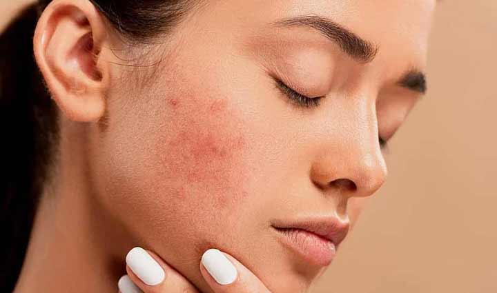 benefits of kiwi fruits for you skin,beauty tips,beauty hacks