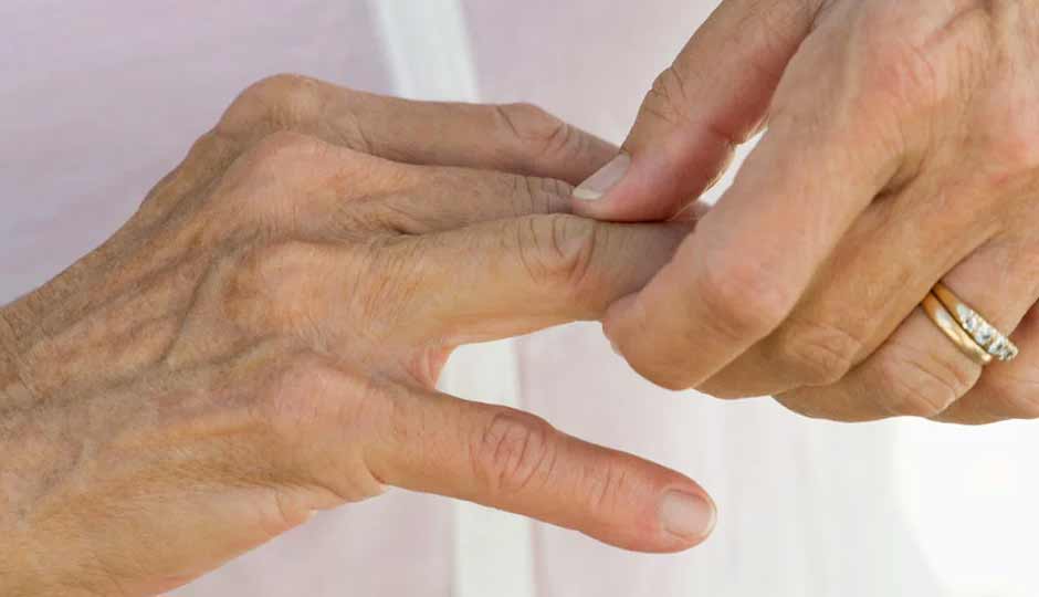 12 Home Remedies to Treat Knuckle Pain Naturally