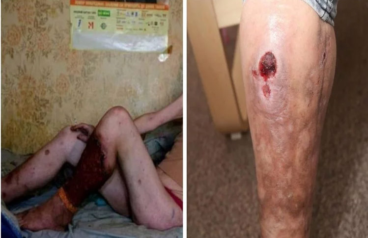 krokodil drug,krokodil drug ingredients,desomorphine,heroine,worlds deadliest drug,britain,krokodil,drug,weird story hindi