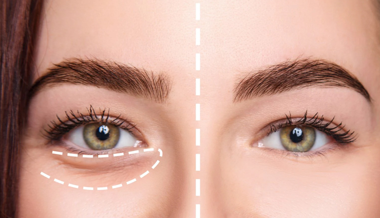 kumkumadi tailam,beauty benefits of kumkumadi tailam,skin care tips,beauty tips