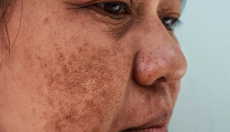 kumkumadi tailam,beauty benefits of kumkumadi tailam,skin care tips,beauty tips