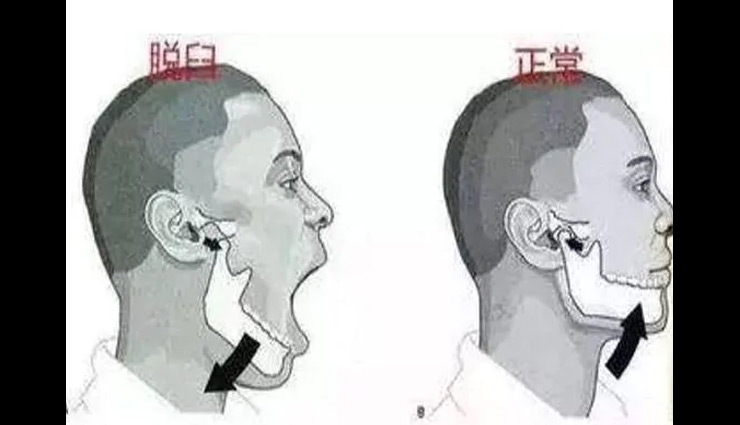 laughing woman,loud laugh,mouth remained open,china,weird news in hindi