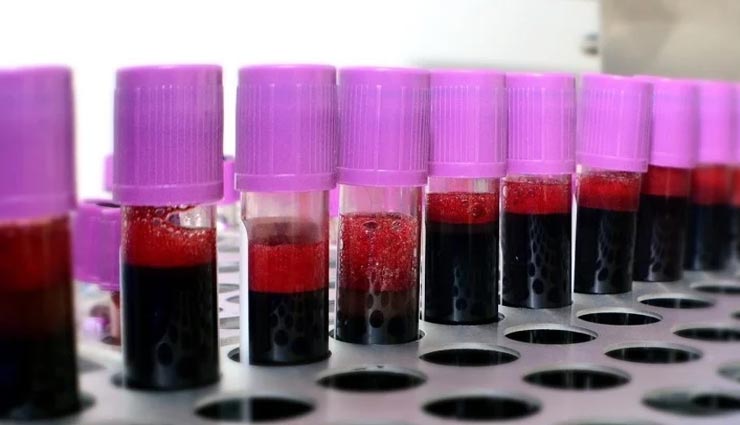 बेहिसाब फायदों से भरपूर हैं जीरा, जानकर ही चौंक जाएंगे आप Health tips,health tips in hindi,cumin seeds,cumin seeds benefits