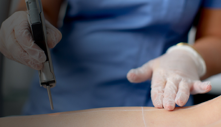 योनी के बालों से छुटकारा पाना चाहती हैं तो आजमाएं ये तरीके, जानें इनके बारे में vulva hair,how to remove vulva hair,vulva hair removing,home remedies to remove vulva hair