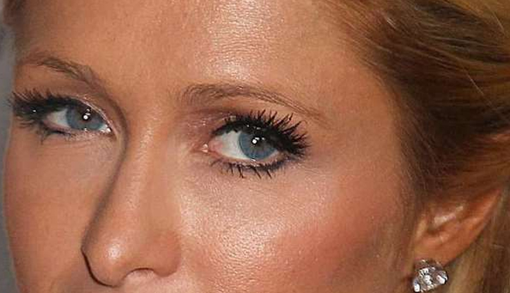 eye problems,eyes care,eye problem,blurred vision,lazy eye,diabetic retinopathy,cataract,glaucoma,blepharitis,crossed eyes,Health