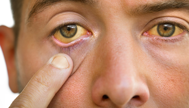 peepal tree benefits,bodhi satva health benefits,ayurvedic benefits of peepal tree,peepal tree leaf uses,cold relief with peepal leaves,fever reduction with peepal leaves,peepal leaves for asthma,eye pain treatment with peepal leaves,oral health benefits of peepal leaves,jaundice treatment with peepal tree,peepal leaves for digestive problems,constipation relief with peepal leaves,dysentery treatment with peepal leaves,peepal leaf ayurvedic remedies,peepal tree traditional medicine,peepal leaf health properties,peepal tree medicinal uses,bodhi satva leaf benefits,natural remedies with peepal leaves,peepal leaf ayurveda therapy