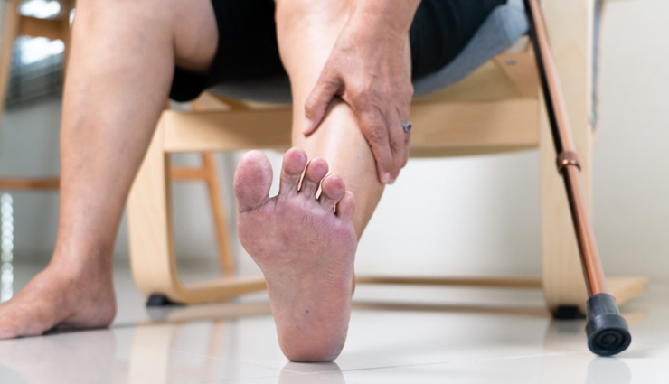 पैरों में पड़े छाले पहुंचाते हैं पीड़ा, इन घरेलू उपचार से मिलेगी राहत 