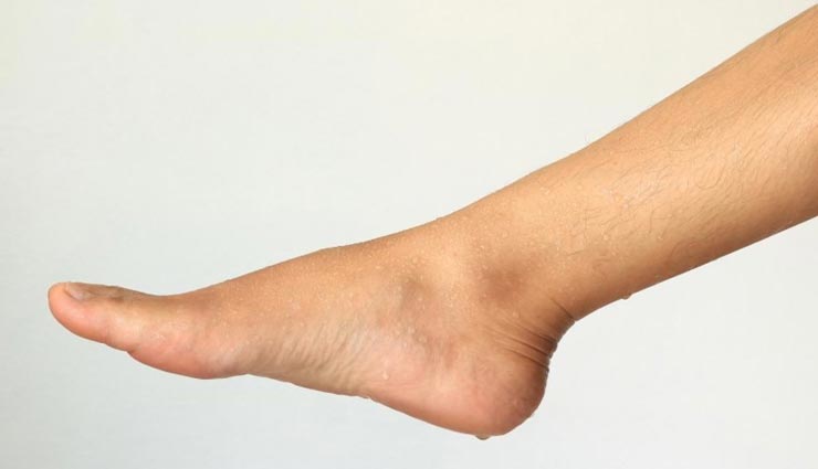Health tips,health tips in hindi,home remedies,sweat problem in foot,foot smell remedies