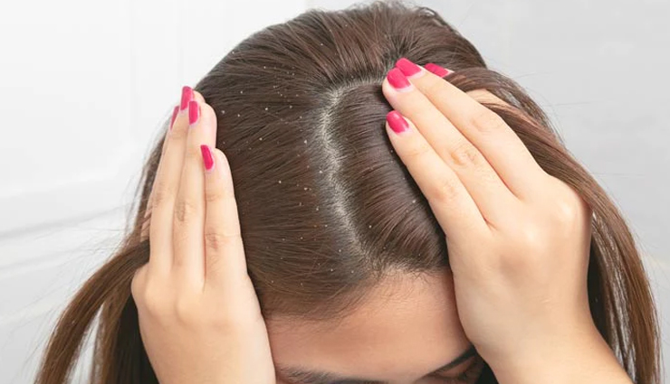 lemon essential oil,beauty benefits of lemon essential oil,skin care tips,beauty tips,lemon essential oil for skin