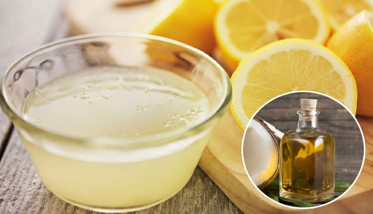 dandruff treatment,natural remedies for dandruff,get rid of dandruff naturally,home remedies for dandruff,dandruff home treatments,how to cure dandruff naturally,essential oils for dandruff,apple cider vinegar for dandruff,coconut oil for dandruff,aloe vera for dandruff