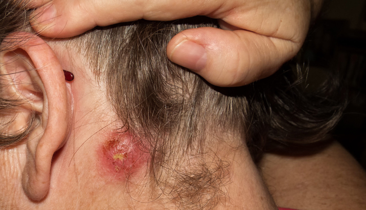 lemon verbena,health benefits of lemon verbena,Health tips,fitness tips