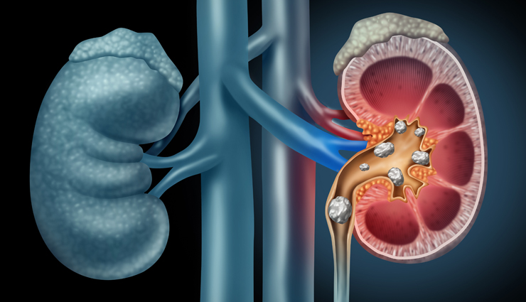 lemon water benefits,lemon water health benefits,benefits of lemon water for health,lemon water advantages,reasons to drink lemon water,health benefits of drinking lemon water daily,lemon water for weight loss,lemon water for skin,lemon water for digestion,lemon water detox benefits