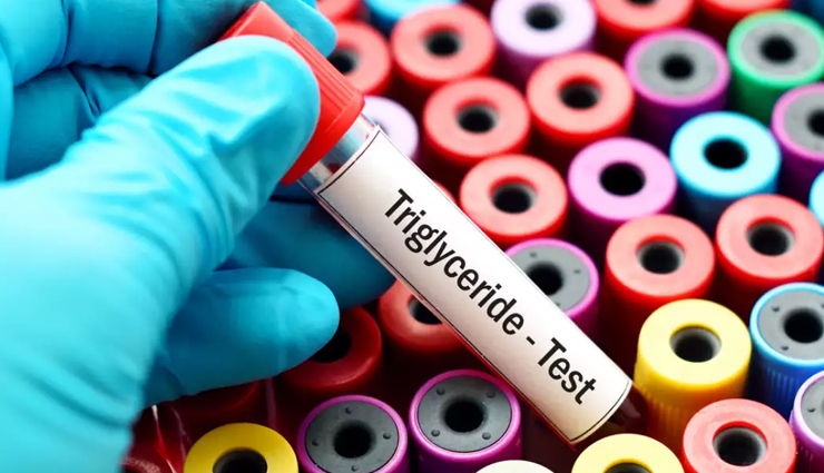 leptin levels,tips to manage leptin levels,Health tips,fitness tips