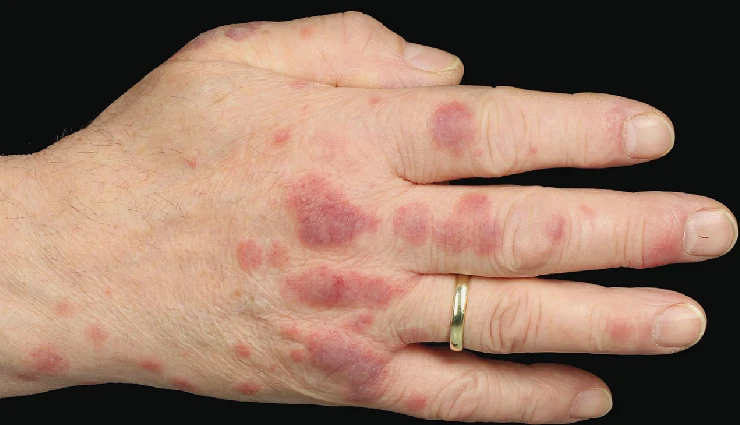 types of cancer,most common cancers,breast cancer,lung cancer,blood cancer,colon cancer,prostate cancer,cancer effects on body,causes of cancer,cancer risk factors,cancer fatality rate,cancer awareness,abnormal cell growth,cancer treatment,cancer impact on organs