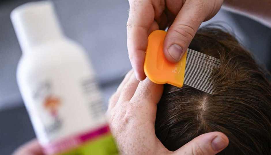 7 Home Remedies to Treat Lice in Kids Naturally