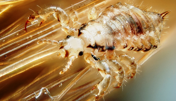 scalp scabs treatment,treating scabs on the scalp,get rid of scalp scabs,home remedies for scalp scabs,scalp care tips,scab removal methods,scalp health advice,healing scalp sores,natural remedies for scalp scabs,preventing scalp scabs