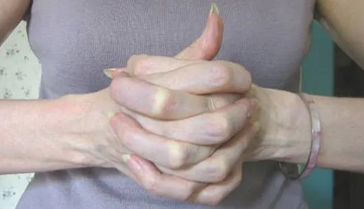 mudras for cholesterol control,natural remedies for lowering cholesterol,hand gestures for cholesterol management,yoga mudras for reducing cholesterol,effective mudras for controlling cholesterol,mudras for healthy lipid levels,holistic approach to cholesterol management,natural ways to reduce cholesterol,mudras for lipid control,cholesterol prevention techniques