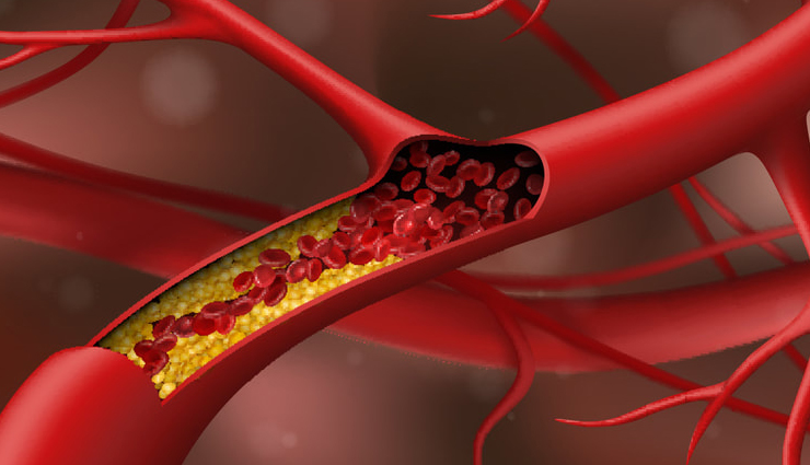 tobacco and cardiovascular diseases,deadly connection between tobacco and cardiovascular health,smoking and heart diseases,tobacco use and cardiovascular risks,effects of smoking on the heart,smoking-related cardiovascular conditions,tobacco addiction and heart health,link between tobacco and heart diseases,smoking cessation for cardiovascular wellness,preventing heart diseases caused by tobacco