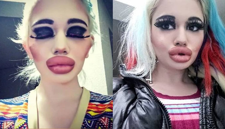 बार्बी डॉल बनना चाहती है ये महिला, अपने होंठों का आकार किया चार गुना weird news in hindi,lips,women lips,big size lips,barbie doll
