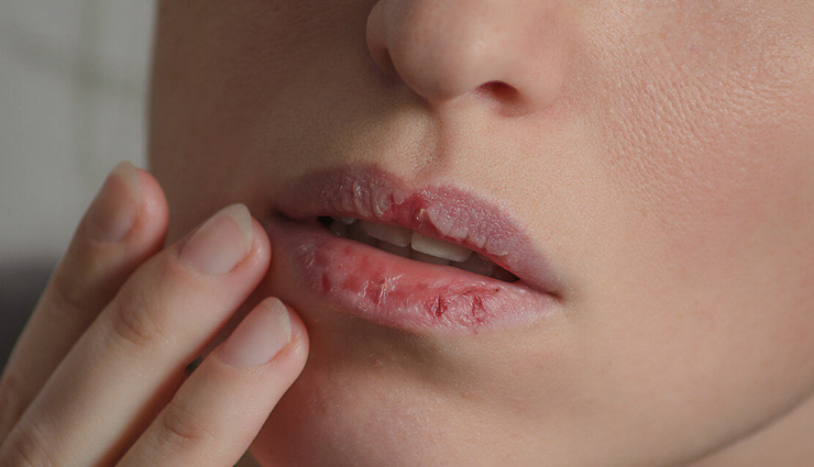 vitamin e capsules,vitamin e capsules benefits,vitamin e benefits,beauty,beauty tips