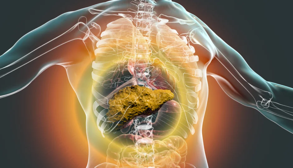 लिवर सिरोसिस कितना खतरनाक है, जानें किस स्टेज में यह बदल सकता है कैंसर में?