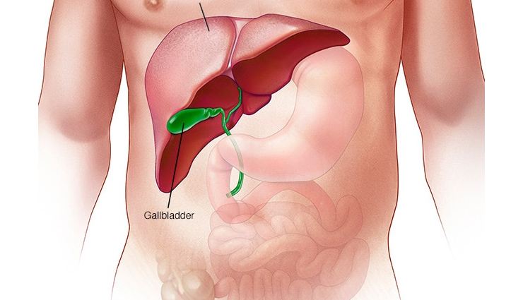 Hepatits B- How Bacteria Helps To Spot Liver Disease