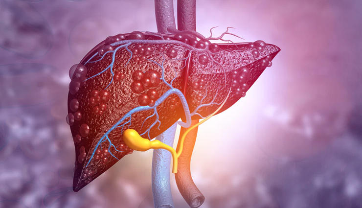 रोजाना इन चीजों को पीना लीवर को कर देता है खोखला, तुरंत बना ले इनसे दूरी 