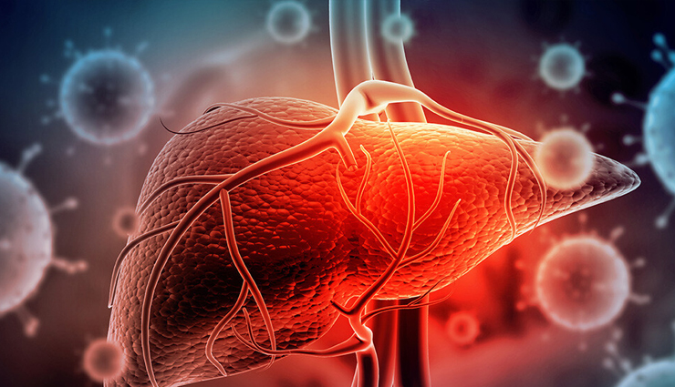 what is jaundice,jaundice causes,jaundice symptoms,jaundice treatment,jaundice,healthy living,Health tips