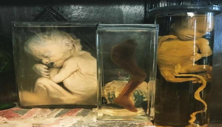 weird news,weird shop,weird pickle,london essex shop,human body part pickle