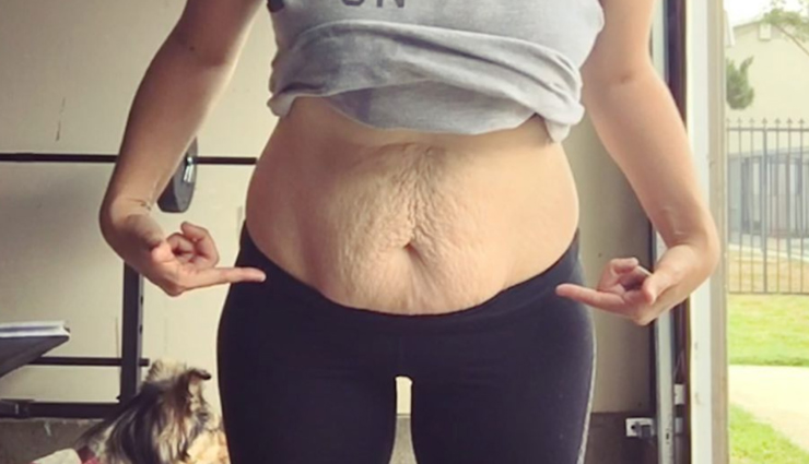 5 Home Remedies To Tighten Loose Belly Skin