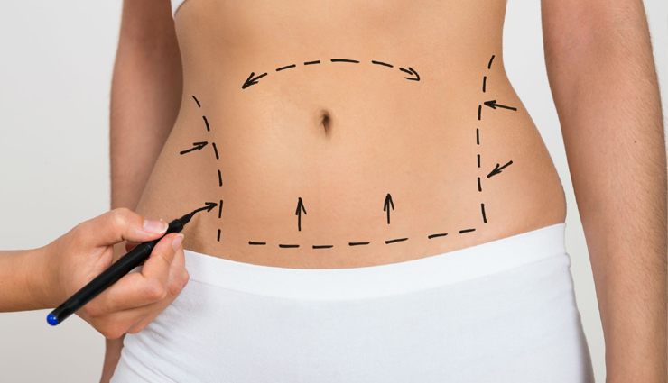 home remedies,tighten loose belly skin,belly skin,beauty tips,skin care tips