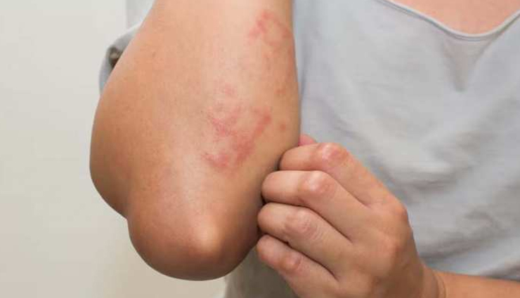 कमजोर प्रतिरक्षा प्रणाली की ओर इशारा करते हैं ये संकेत, जानें और इम्युनिटी पर दें ध्यान low immunity,signs of low immunity,Health tips,fitness tips