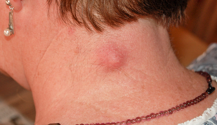 mouth cancer,symptoms of mouth cancer,cancer,suffering from mouth cancer,Health,cancer symptoms,Health tips,healthy life,healthy living