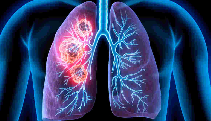 quitting smoking benefits,health advantages of quitting smoking,benefits of being smoke-free,smoke-free lifestyle benefits,smoking cessation health benefits,improved circulation after quitting smoking,respiratory system recovery after quitting smoking,heart health improvement from quitting smoking,long-term benefits of quitting smoking,quit smoking timeline of health benefits