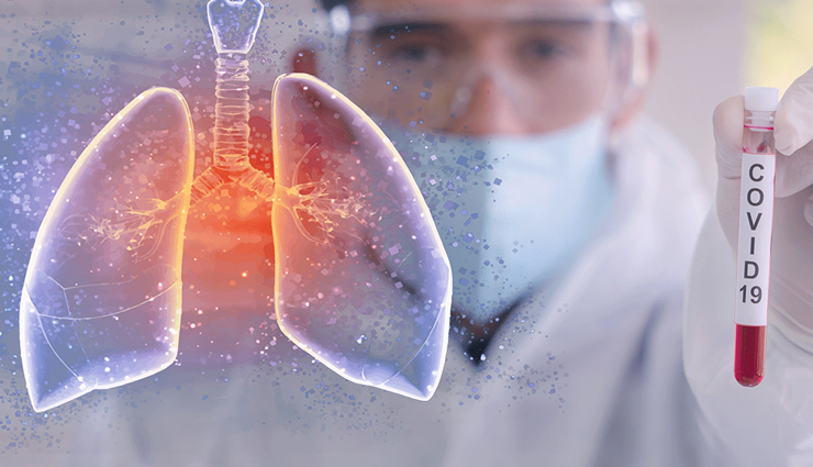 Keep Your Lungs Healthy During COVID-19 With These Measures