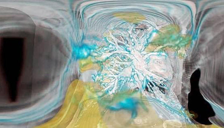 coronavirus,lungs,coronavirus lungs,Health