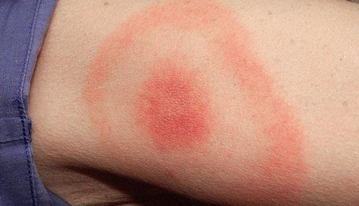 cistus tea benefits,health advantages of cistus tea,drinking cistus tea for wellness,cistus tea health properties,cistus herbal tea benefits,benefits of consuming cistus tea,cistus tea for natural health,cistus tea benefits for the body,health perks of cistus tea,cistus tea medicinal benefits,cistus tea immune support,antioxidant properties of cistus tea,cistus herbal tea advantages,cistus tea for digestive health,anti-inflammatory effects of cistus tea,cistus tea for respiratory wellness,cistus tea and its antibacterial benefits,cistus tea holistic health benefits,cistus tea natural remedies,cistus tea for overall well-being